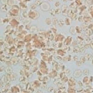 fenbendazole cancer clinical trials