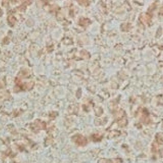 fenbendazole cancer protocol