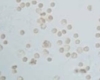 fenbendazole cancer success stories