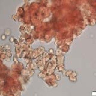 fenbendazole stage 4 cancer
